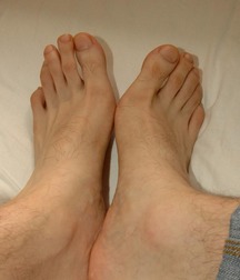 Top of my feet 56d1752c9b877.jpg