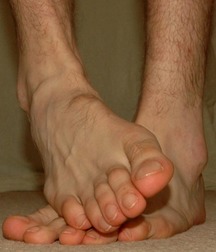 Top of my feet 56d17532bb6ad.jpg