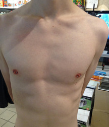 Pierced Nipples 06 574b8cb59bbf1.jpg