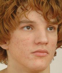 Alex Sexy Curly Boy Set 57cca584c11a4.jpg