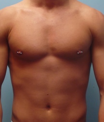 Pierced Nipples 09 586b131336fda.jpg