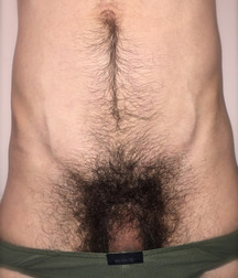 Hairy Dicks 09 5875984949246.jpg