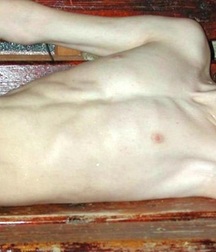 Skinny Boys 06 5ac9ecae4dcaa.jpg