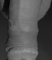 Pierced Cocks 02 5b9caf007b25f.jpg