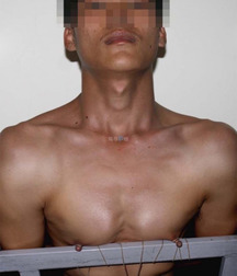 Tasty Nipples 31 5bdf8d128bebd.jpg