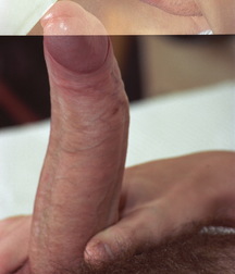 Teen with huge cock 579a9f2a79eb6.jpg