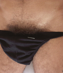 Young & hairy 579ba821eb2a1.jpg