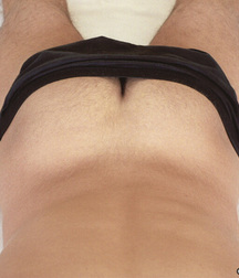 Young & hairy 579ba82456193.jpg