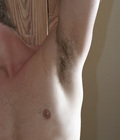 Hairy teen 57acd9da554f9.jpg
