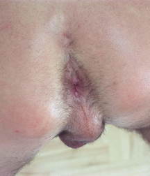 Teen model 57ca158410563.jpg