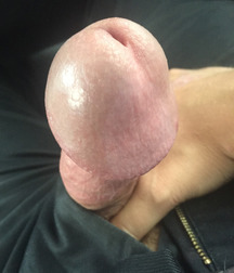 twinks mushroom head 5884898d29237.jpg