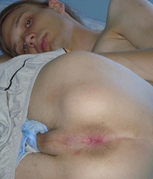 Opeldriver: Butts 22 5a6563a27736a.jpg