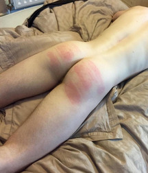 Opeldriver: Butts 33 5d6ba4af24289.jpg