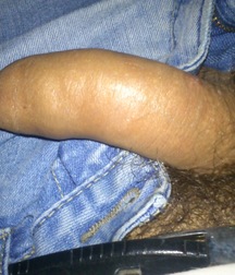 boys Polish young sex 585913e5ea748.jpg