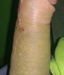 boys Polish young sex 58591887e467b.jpg