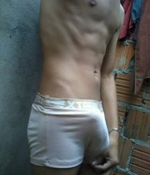 something swelled in his underwear 588bbcb332919.jpg