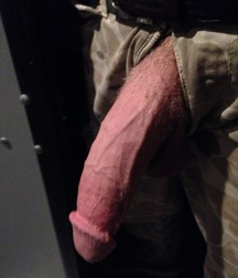 put out the cock 58b3c6eaf4135.jpg