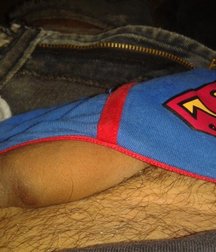 foreskin intact 58c043f9b5f25.jpg