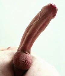 foreskin intact 58c043fb6658f.jpg