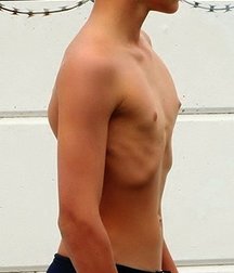 Boys in swimsuit 58f84558b0d5b.jpg