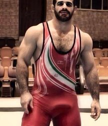 The weird swelling of the athletes 58fce2d4e1f8b.jpg