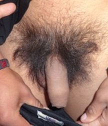 foreskin 5911d1204f013.jpg