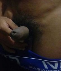 foreskin 5911d125ad1f9.jpg
