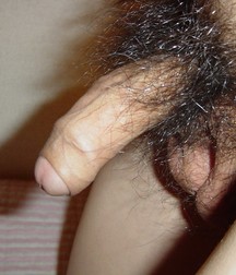 foreskin 5911d12e4f247.jpg