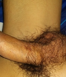 The morning's erection 598383e2ac493.jpg