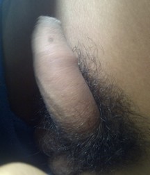 The penis and its foreskin 5992c5f5adc34.jpg