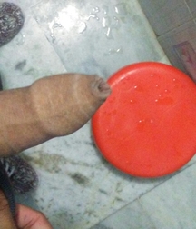 The penis and its foreskin 5992c5fadfedd.jpg