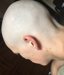 Boys with a completely shaved head 5999daca2e2c2.jpg