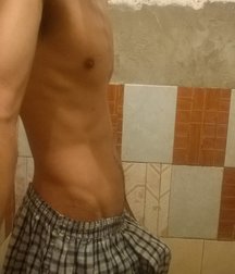 swollen underpants 59e8ff5e18083.jpg