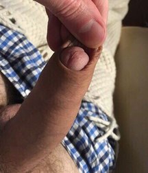 play with the foreskin 5bd6e60d0e331.jpg