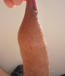 prohibited to circumcise 5cc72208863b8.jpg