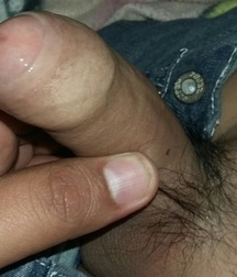 the intact foreskin 5d6410aa12e10.jpg