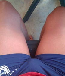 swelling between the legs 5da47cc4d8871.jpg