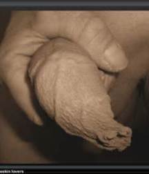 foreskin 57e823815151d.jpg