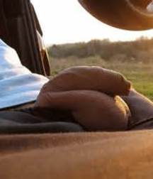 foreskin 57e823b67e79c.jpg