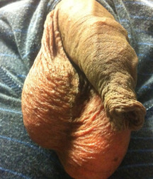 foreskin 57e823fca6d28.jpg
