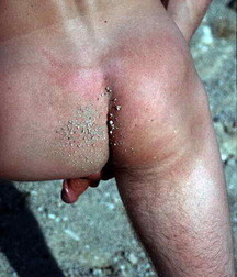 Denis 58d9395626a1f.jpg