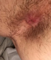 boys nude 5d1e4a112ad0c.jpg