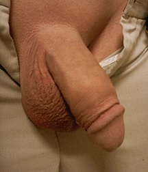 circumcised dicks 581b540ff32e3.jpg
