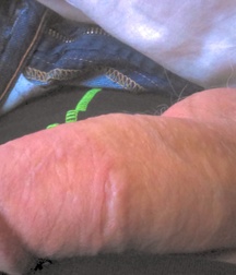 circumcised dicks 581b54111b897.jpg
