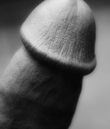 circumcised dicks 2 582c63ee53993.jpg