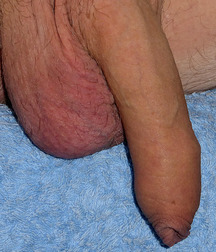 real-world-dicks_170329a 58dd0663d98a5.jpg