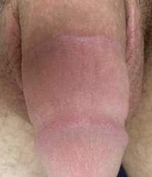 adult circed dicks 58e25bb56950c.jpg