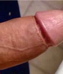 adult circed dicks 58e25bcd50f5a.jpg