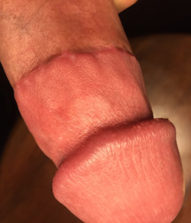 adult circed dicks 58e25bd782f1b.jpg