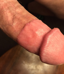 adult circed dicks 58e25bd99b4ca.jpg